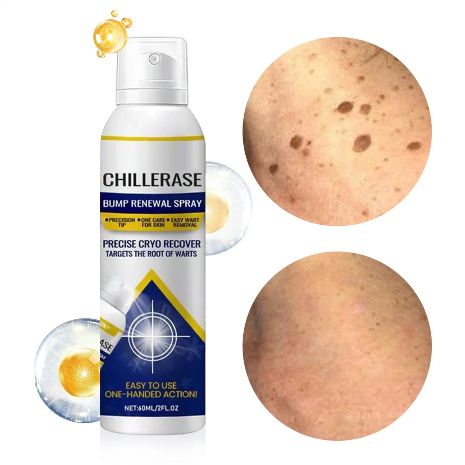 Chill Erase Bump Spray
